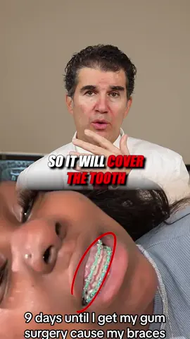 Did this happent to you? 🤔 #braces #orthodontist #dentistsoftiktok #drrocco #fyp 