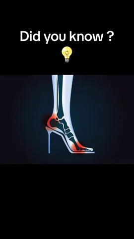 Did you know ? #heelpain #goodthing #vita #ems #relief #pain #heels #wellness #relax#mybodymychoice 