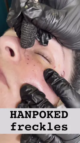 Handpoked freckles , stars, and moon face adornments for lorna! The face is always a bit irritated after the freckles are applied, but lightens and settles within the same day. I would love to do more of these. 🌙  #handpoke #orlando #orlandotattoos #freckles #freckletattoo #facetattoo #moon #stars #stickandpoke #cosmetictattoo #tattoo #femaletattooartist 