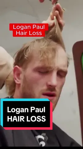 Logan Paul and Jake Paul both have the hair loss gene inherited from their dad. Now as a WWE athlete, Logan is adding fuel the fire of male pattern baldness. #balding #hairloss #loganpaul 