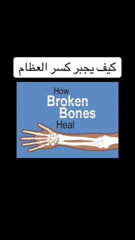 #ترجمة #fyp #fypシ  #bone  #medical  #كسور 