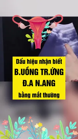 Dấu hiệu nhận biết buồng trứng đa nang bằng mắt thường #mongcon #mongconhiemmuon #hiemmuon #hiemmuonmongcon #botrung #botrungdieukinh #chiavia #xinvia #buongtrungdanang #danangbuongtrung #kinhnguyet #kinhnguyetkhongdeu #kinhnguyetkodeu #bshongvan #ovaq1 #ovaqplus #spermq #trending #xuhuong  @BS Hồng Vân 