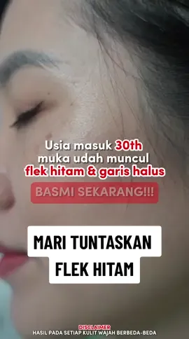 Tuntaskan flek hitam membandel. Hasilnya beneran nyata loh 😍 #leikaskincare #flekhitam #tuntaskanflekhitam #memudarkanflekhitam #glowingnightcream 