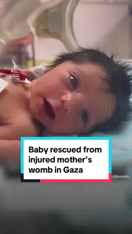 A medical team in #Gaza was able to rescue this baby from its mother's womb after she was seriously injured. #palestine #israel #gazastrip #news 