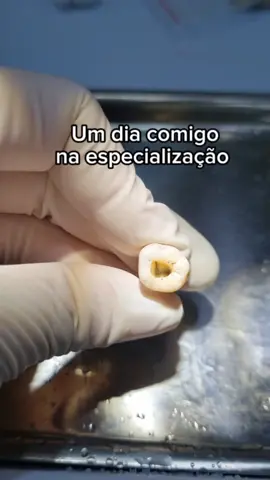 Vem ver como é um dia na especialização de endodontia!! #endodontics #endo #dentista #odontologia #saoleopoldomandic 