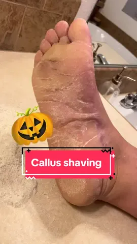 Zombie skin? 😆 #parmeseanpalms 