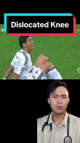 Dislocated knee from soccer #football #kneecap #injury 