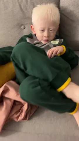 #fypシ #抖音 #chineseboys #albinism #TikTokHalloween 