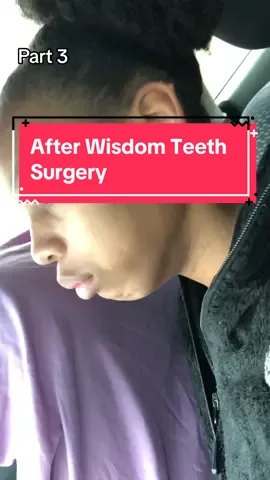 After wisdim teeth removal🤣🤣  @Sheronda🌻 #wisdomteethsurgery #wisdomteethremoval #underanesthia #funnyvideos #wisdomteeth #teeth #funny #dentristy #postsurgery #kidsonanesthesia #funnymemories #wisdomteethaftermath 