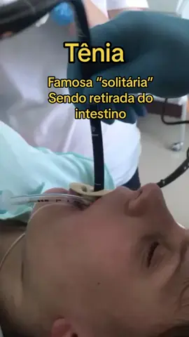 Tênia sendo removida #tenia #tenianointestino #removendotenia #fy #vaiprofycaramba #viral #tiktok #trend 