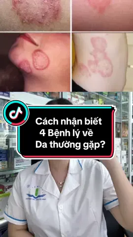 Bệnh ngoài da tuy không nguy hiểm nhưng ảnh hưởng đến chất lượng cuộc sống, khiến người bệnh ngứa ngáy, khó chịu và tự ti với vẻ bề ngoài,....#bệnh#da#dalieu#viemda#lacdongtien#cham#eczema#gioileo#vaynen#duocsi#tuvansuckhoe#duocsicuc91 