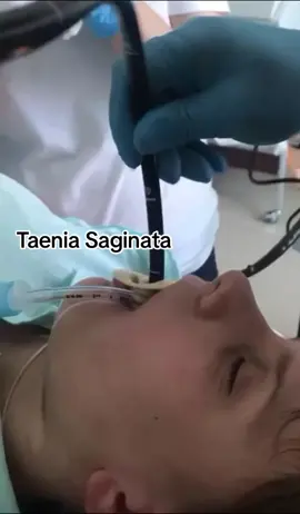 Taenia Saginata.  Pra quem ama comer uma carne mal passada, sangrando, sangrenta🩸 Aí está a importância de você limpar seu terreno.  Os   Vermes enfraquece  nosso sistema imunológico.  A melhor forma é fazer uma vermifugação natural.  #taenie #teniase #vermes #parasitas #vermifugacao #desparasitarse #salud #terreno #bichosraros #doenc #sintomas #tiktok #foryou #tenia #fy #trend 