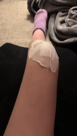 I could never imagined how difficult it could be to bend my own leg like that. 22 days after the surgery, I managed this (for me) huge step. I can also manage to bend my knee up to 30 degrees in the movement rail. On average, I need painkillers only once or twice a day. I'm really proud of myself. Btw, my leg circumference has reduced by 2 cm. #kneecapdislocation #patellardislocation #patellaluxation #surgery #injury #knorpelschaden #cartilagedamage #kneepain #mpflplastik #mpflreconstruction #hospital #operation #recovery #genesung #bewegungsschiene 