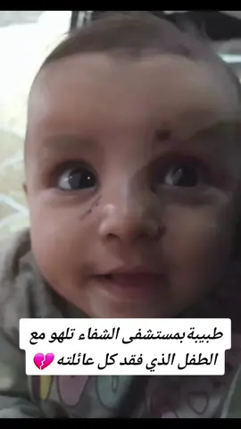 💔😔#غزة_العزة #فلسطين #غزه#فلسطين🇵🇸 #القدس_لنا🇵🇸🕌 #فلسطين_تحتاج_لنا🇵🇸💔  #اكسبلورexplore #foryou #fypシ #اصمدي_ياغزة_العزة_القصف_بهون #مشاهير_العالم #اليمن #بنت_القضيه #fypシ゚viral #free_palestine🇵🇸🇩🇿🇲🇦🇹🇳🇧🇩🇵🇰 #تحيا_مصر🇪🇬_وتحيا_فلسطين🇵🇸_حره_عربيه #الشعب_الصيني_ماله_حل #الله_اكبر #طوفان_القدس #طوفان_فلسطين #طوفان_الأقصي #اكسبلورexplore #يارب_انصر_فلسطين #دعواتكم_لغزة_وشعبها🥺 #الله_اكبر #fyp #fypシ゚viral #foryoupage #viral #فلو #فولو 