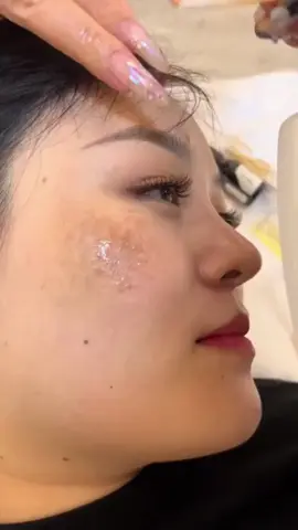 Kem Giảm Nám Trắng Da Mờ nếp nhắn vùng khoé mắt công nghệ nhật bản. #kemnam #kemtrinamucm #trinamvatannhang #kemkhunamvatannhang 