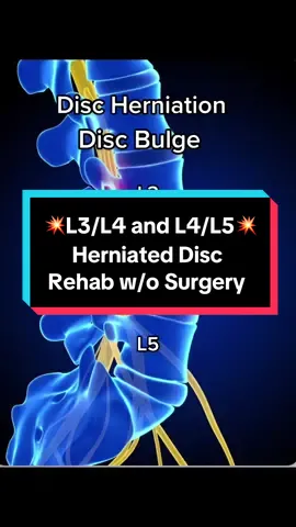 #l3l4disc #l4l5 #l5s1 #backpainstretches #backpainexercises #discherniation #herniateddisc #backpainrelief #backpaintreatments #fyp #primespinewellness #bethesdamaryland