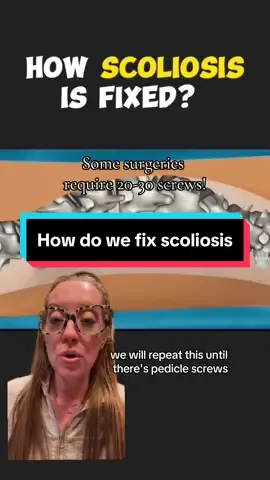 How does a spine surgeon fix #scoliosis ? #spinesurgery #neurosurgeon #orthopedics #spinehealth video in background by:  @Medical World 3D 