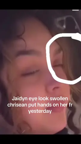 Chrisean got jaidyn eye swollen #fyp #chriseanrock #foryoupage #bluefacebaby #chriseanjr #jaidynalexxis #chrisean #chriseanrockcrazyinlove #blueface #chriseanbeatjaidynup #chriseanandjaidyn @chriseanrockbaby @Blueface #bluefacebabymoms 