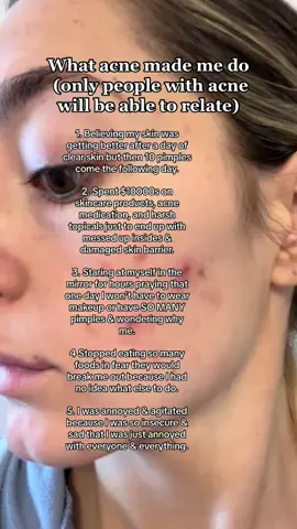 Only my acne people will understand 🥹🤍  #skincare #skin #skincareroutine #acneskin #acne #acnescarring #skinbarrierrepair #acnescars #acnetreatment #skintok #clearskintips #skincareresults #acnebeforeandafter #clearskinproducts #skinbarrier #skincaretips #clearskin #clearskinroutine #hormonalacne #hormonalimbalance #balanceyourhormones #accutane 