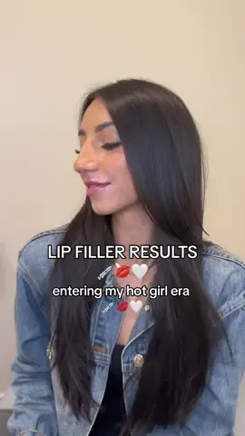 After getting my hair and lips done in the same day 💉💋🤍 #hotgirlera #hotgirl #lipfillers #lipfiller #BeautyTok 