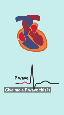 EKG Interpretation song? SAY LESS🫀😮‍💨 #nursemikesmemorymusic #simplenursingsong #ekginterpretation #memorymusic #nursing #nursingschool #nurselife