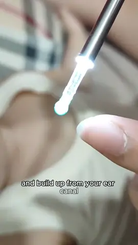 Natfire NE3 Ear Cleaner - Wireless Smart Ear Cleaning Kit