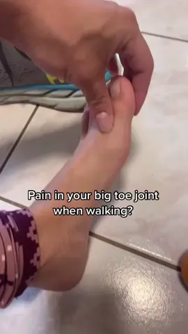 Custom insoles with certain modifications can be made for this problem as well🦶(a lot of my patients say Hokas look like clown shoes😂)… I don’t think they’re that bad! 