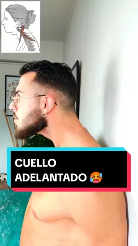 Enséñale este video a toda persona que consideres que puede ayudarle Cuello adelantado, cabeza adelantada o cuello de texto? Entonces necesitas realizar este ejercicio de control postural todos los días En multitud de ocasiones, el cuello adelantado o el cuello de tortuga, aparecen como resultado de un desequilibrio muscular por parte de la musculatura profunda de tu cuello Cuando tus esternocleidomastoideos se encuentran demasiado tensos y rígidos, estos, inhiben y elongan tus flexores profundos del cuello, dando lugar a la antepulsión de tu cabeza Este adelantamiento del eje central de tu cabeza, más allá de alterar tu estética, también fomenta la rectificación cervical, la cervicalgia, el dolor de cuello y la hernia discal cervical, por lo tanto, abordar este desequilibrio muscular es algo realmente importante Con este maravilloso ejercicio de corrección postural conseguirás corregir poco a poco esta condición #pablopilatesreal #cuelloadelantado #cabezaadelantada #cuellodetortuga #cuellodetexto #dolordecuello #textneck #neckpain #cervicalgia #rectificacioncervical #cervicobraquialgia #controlpostural #higienepostural #fibromialgia 