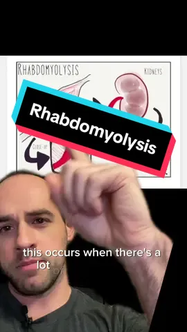 Rhabdomyolysis aka Rhabdo #overtraining #rhabdomyolysis #exercise #Fitness #musclesoreness #workout #rhabdo #resurgencept #health #FitTok 