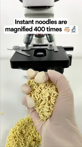 Oh my god😰😰😰#foryou #fyp #undermicroscope 