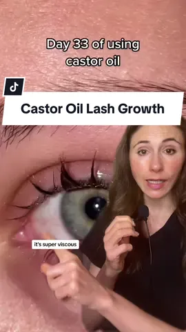 #duet with @Glow up #ShowOffLandOFrost Castor Oil For Lash Growth? While there is no evidence that castor oil can directly grow hair, it is very viscous & hydrating. Castor oil coats the lashes, making them appear thicker & reducing lash breakage. Ricinoleic acid in castor oil may act like prostaglandins, impacting the hair growth cycle to promote lash growth. However, this has not been proven yet, so take it with a grain of salt. Risks of using castor oil for lashes include allergic skin reactions & eyelid irritation. #castoroilforeyelashes #castoroillashes #castoroilbenefits #dermatologist 