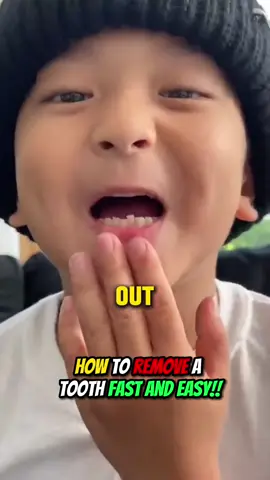 How to quickly remove a tooth!!😂🤯 Follow @The Shluv Family For More!!