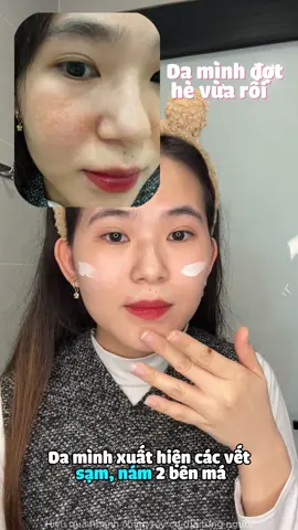 Các bà bị nám giống tuii thì dùng thử ngay siêu phẩm này nhé ❤️ Siêu hiệu quả luôn ạ
