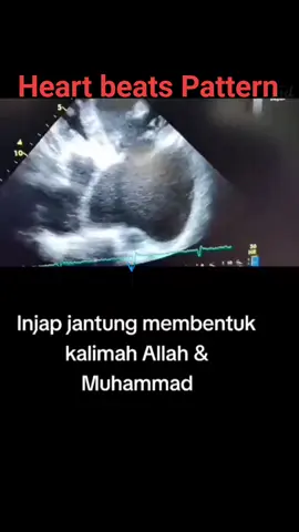 Every Heart beat Patterns produces Allah الله and Muhammad مُحَمَّد during Inhale and Exhale continously...The Heart beat Sounds 
