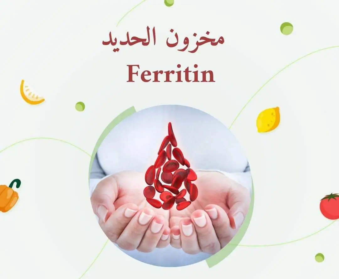 #pharmacy_art #eshak_marzouk 