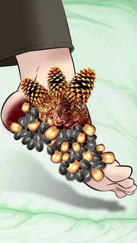 Maggot Removal from Foot - ASMR Animation #asmr #animation 