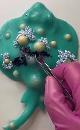Lets remove the gross slime before popping some pimples!! #fypシ #oddlysatisfying #viral #asmr 