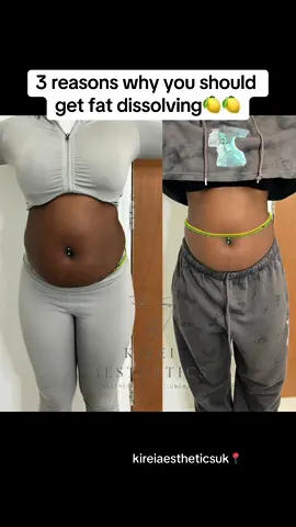 My clients results after her first session of fat dissolving using lemon bottle😍 #lemonbottle #lemonbottlefatdissolving #fatloss #weightloss #aestheticclinic 