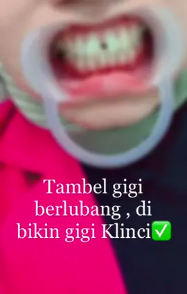 Fyki gigi (lokasi cikarang selatan gaess #fyppppppppppppppppppppppp 🦷✅