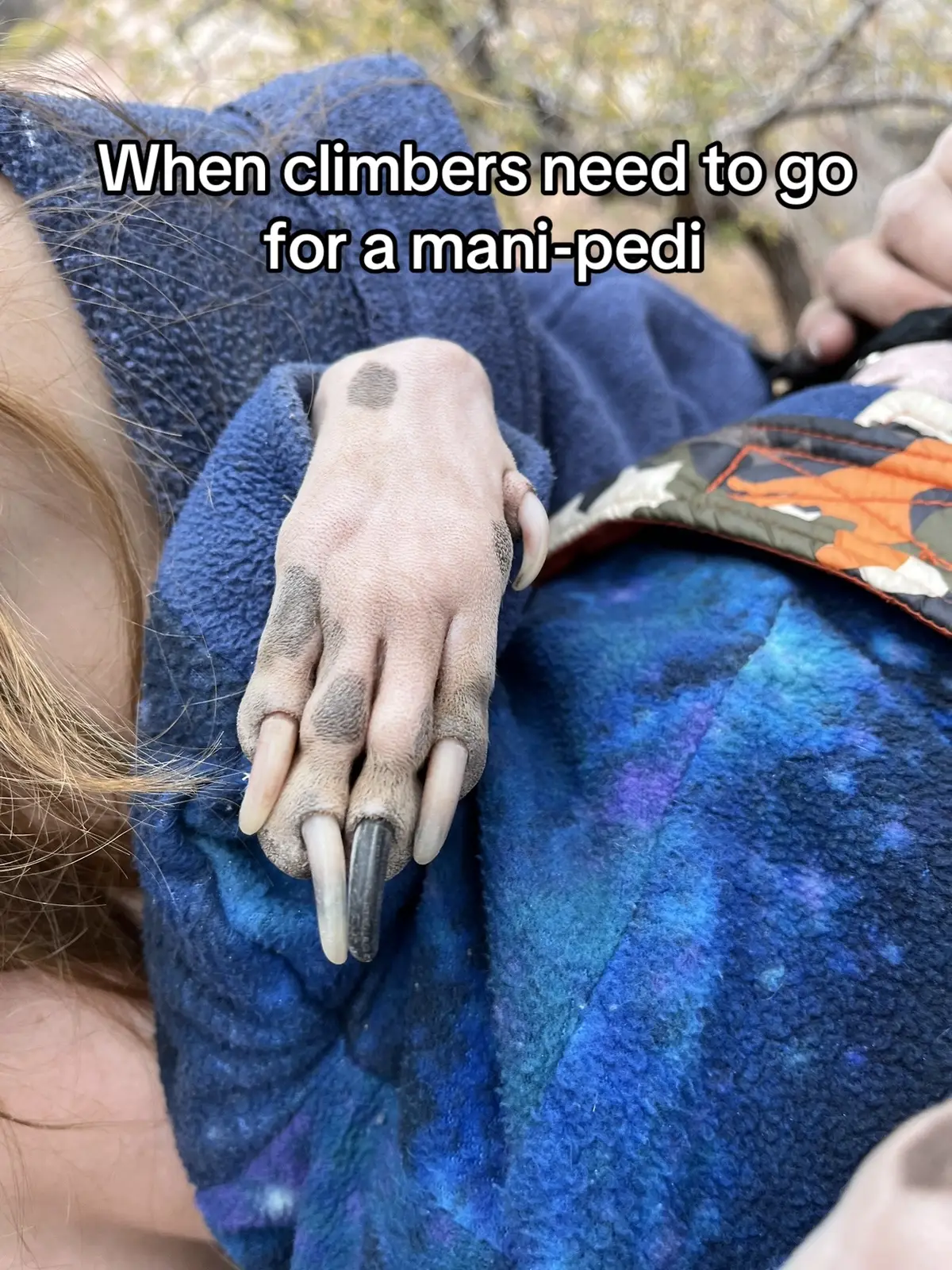 I obsessively trim my fingernails but often neglect my toes 😅  #climbing #climbingtiktok #climbers #climbersoftiktok #climbtok #bouldering #girlswhoclimb #climbinggym #boulderinggym #rockclimbing 