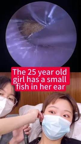 #earwaxremoval #cleanearwax #fyp #fup #earwaxcleaning 