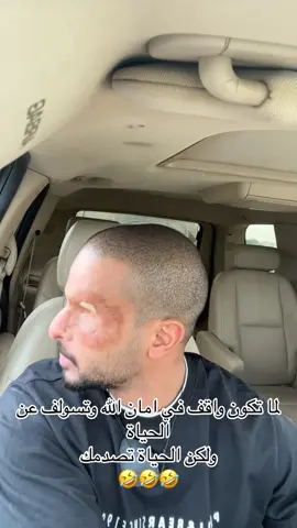 ما زال الفيديو يذبحني  🤣🏃🏽‍♂️ Snap:alnassarmk #الشعب_الصيني_ماله_حل😂😂 