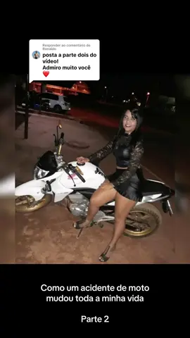 Respondendo a @Ronaldo #minhahistoria #acidente #moto #amputada #amputeetiktok #dificuldades #superacao #acidentedemoto 