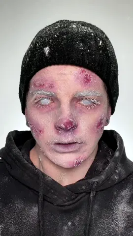 “I’m cold” makeup trend but make it sfx frostbite! 🥶❄️ I wanted to go for more realistic and less artsy how did i do? 🥹  Trying a new lighting setup and I love how crisp the videos look now (also trying not to add smoothing filters bc texture is normal).   #frostbitemakeup #sfxmakeup #coldgirlmakeup #imcoldmakeup 