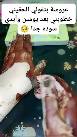 الماسك ال هيخلي ايدك بتنور في الضلمة #وصفات_طبيعية #بشرة_صحية #بشرة #skincare #مريم_محمد_خبيرة_تجميل #تبيض #تفتيح 