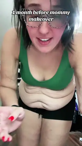 Skipped to the good part #canweskiptothegoodpart #mommymakeover #mommymakeovermexico #mmo #thegoodpart 