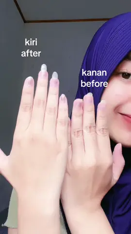 jangan nonton sampe abis nanti keracun!!! #beuatetox #iboomingxbeautitox 