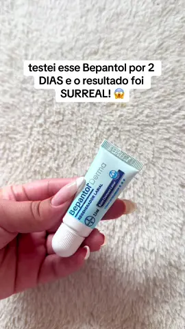 MANOOO O ANTES E DEPOISSSS 😱😱 #skincare #cuidadoscomapele #bocaressecada #roacutan #tiktokbeleza #produtosbaratos 