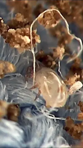 Dust mites could be the source of your allergies!!