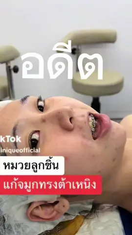 ตอนนั้นคือดราม่าหนักมาก ขอบคุณตัวเองที่ดูแลตัวเองมาได้ขนาดนี้ ของดีบอกต่อค่า #yuriwink #ยูรีวิงค์ #ยูรีวิงค์น้ําชงนางฟ้า 